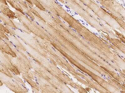 Immunohistochemistry-Paraffin: tropomyosin-2 Antibody [NBP2-99519]