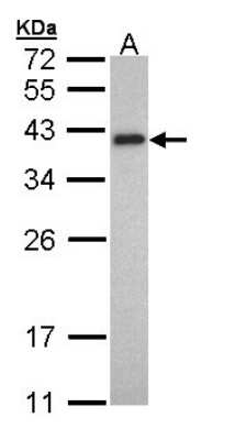 Western Blot: tropomyosin-2 Antibody [NBP1-32770]