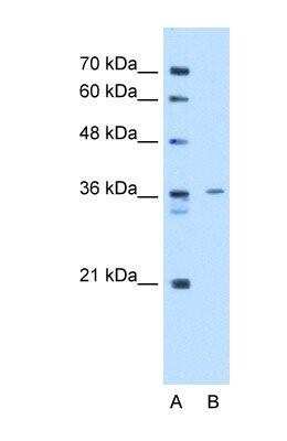 Western Blot: tropomyosin-2 Antibody [NBP1-57612]