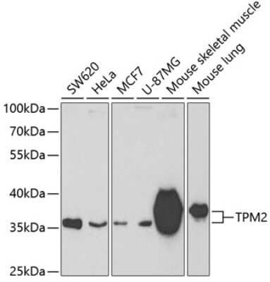 Western Blot: tropomyosin-2 AntibodyAzide and BSA Free [NBP2-95197]