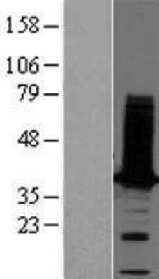 Western Blot: tropomyosin-2 Overexpression Lysate [NBP2-04458]