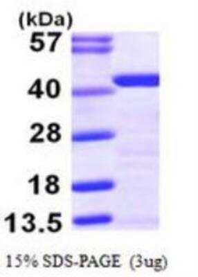 SDS-PAGE: Recombinant Human tropomyosin-2 His Protein [NBP1-50957]