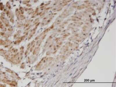 Immunohistochemistry-Paraffin: tropomyosin-3 Antibody (2E4) [H00007170-M02]