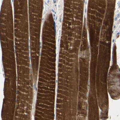 Immunohistochemistry-Paraffin: tropomyosin-3 Antibody [NBP1-87382]