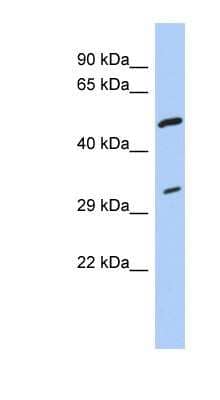 Western Blot: tropomyosin-3 Antibody [NBP1-57472]