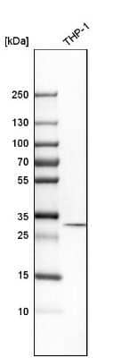 Western Blot: tropomyosin-3 Antibody [NBP1-87382]