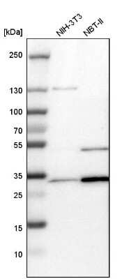 Western Blot: tropomyosin-3 Antibody [NBP1-87382]