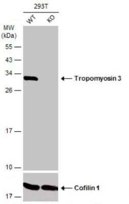 Western Blot: tropomyosin-3 Antibody [NBP2-20732]