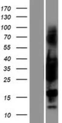 Western Blot: tropomyosin-3 Overexpression Lysate [NBP2-05242]