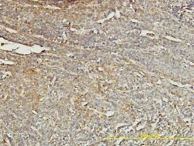 Immunohistochemistry-Paraffin: tropomyosin-4 Antibody (4E4-1D2) [H00007171-M01]