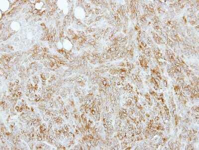 Immunohistochemistry-Paraffin: tropomyosin-4 Antibody [NBP2-15146]