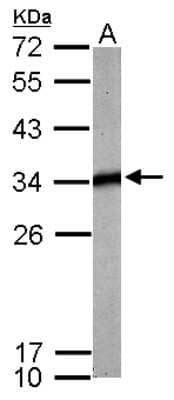 Western Blot: tropomyosin-4 Antibody [NBP2-15146]