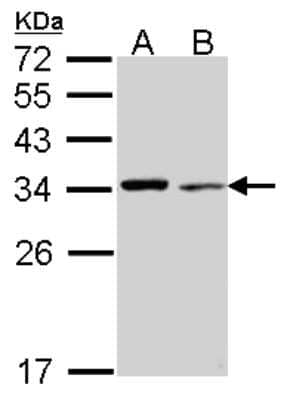 Western Blot: tropomyosin-4 Antibody [NBP2-15146]