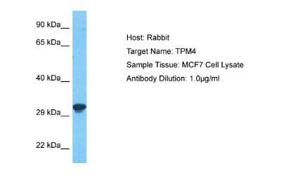 Western Blot: tropomyosin-4 Antibody [NBP2-86873]