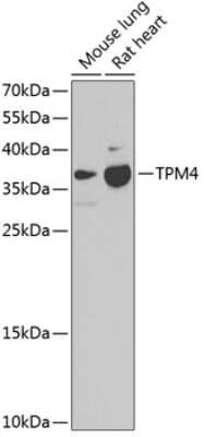 Western Blot: tropomyosin-4 AntibodyBSA Free [NBP2-94880]