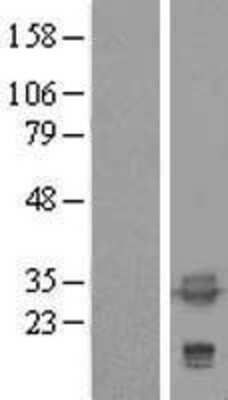 Western Blot: tropomyosin-4 Overexpression Lysate [NBL1-17221]