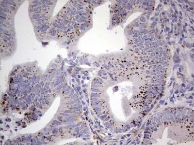 Immunohistochemistry: u-Plasminogen Activator/Urokinase Antibody (OTI5H4) [NBP2-46436]