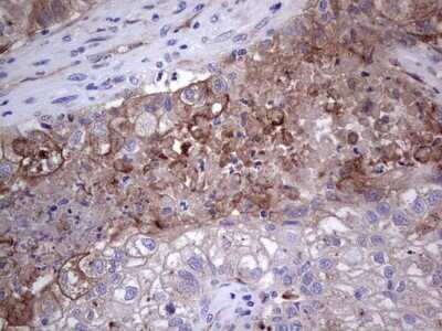 Immunohistochemistry: u-Plasminogen Activator/Urokinase Antibody (OTI5H4) [NBP2-46436]