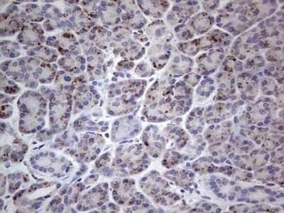 Immunohistochemistry: u-Plasminogen Activator/Urokinase Antibody (OTI5H4) [NBP2-46436]