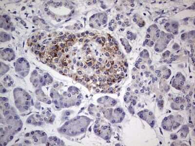 Immunohistochemistry: u-Plasminogen Activator/Urokinase Antibody (OTI5H4) [NBP2-46436]