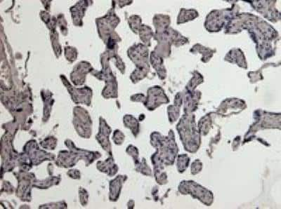 Immunohistochemistry-Paraffin: u-Plasminogen Activator/Urokinase Antibody [NB100-2419]