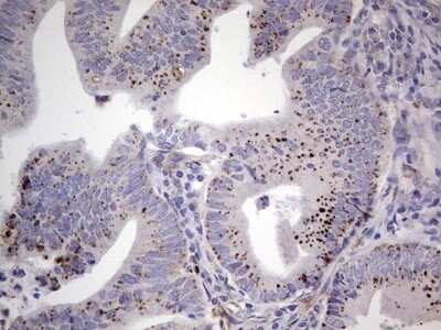 Immunohistochemistry: u-Plasminogen Activator/Urokinase Antibody (OTI5H4) - Azide and BSA Free [NBP2-74793]