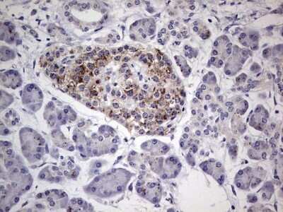Immunohistochemistry: u-Plasminogen Activator/Urokinase Antibody (OTI5H4) - Azide and BSA Free [NBP2-74793]
