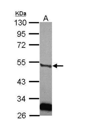 Western Blot: u-Plasminogen Activator/Urokinase Antibody [NBP2-20819]