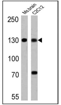 Western Blot: uNOS Antibody (NOS-3F7-B11 B5) [NB120-2801]