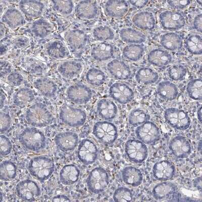 Immunohistochemistry-Paraffin: uPAR Antibody [NBP2-14711]