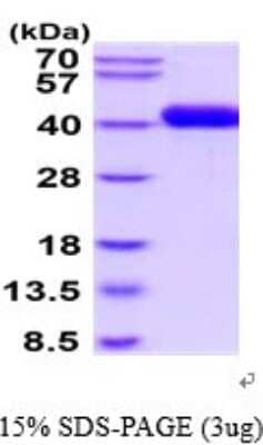 SDS-PAGE: Recombinant Human uPAR His Protein [NBP2-52381]