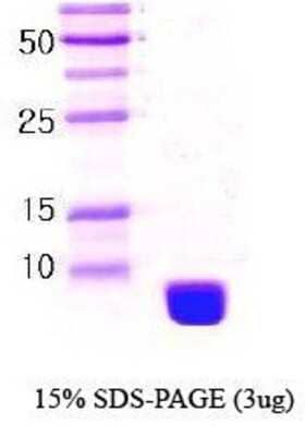 SDS-PAGE: Recombinant Human Ubiquitin C Protein [NBC1-18439]