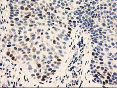 Immunohistochemistry-Paraffin: UNG Antibody (OTI1A11) [NBP2-01194]