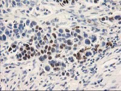 Immunohistochemistry-Paraffin: UNG Antibody (OTI1A11) [NBP2-01194]