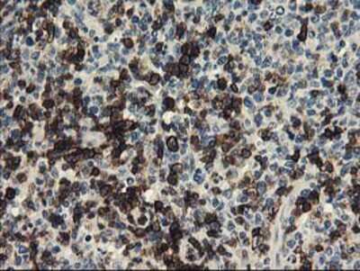 Immunohistochemistry-Paraffin: UNG Antibody (OTI1A11) [NBP2-01194]