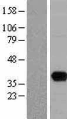 Western Blot: UNG Overexpression Lysate [NBL1-17620]