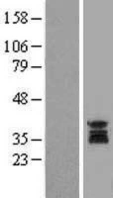 Western Blot: UNG Overexpression Lysate [NBL1-17621]