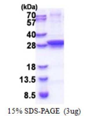 SDS-PAGE: Recombinant E. coli UNG His Protein [NBP2-22637]