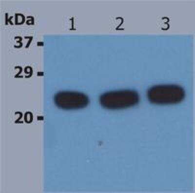 Western Blot: HRAS Antibody (H-Ras-03)BSA Free [NB110-68799]