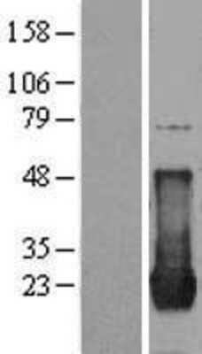 Western Blot: HRAS Overexpression Lysate [NBP2-11106]