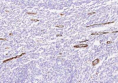 Immunohistochemistry-Paraffin: vWF-A2 Antibody [NBP3-06544]