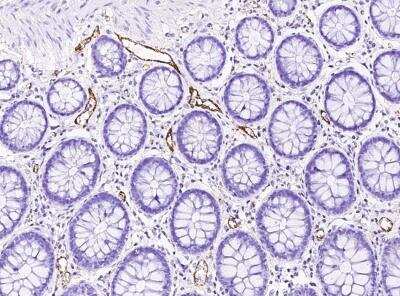 Immunohistochemistry-Paraffin: vWF-A2 Antibody [NBP3-06544]