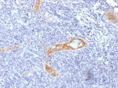 Immunohistochemistry-Paraffin: Von Willebrand Factor Antibody (rVWF/1465) - Azide and BSA Free [NBP3-08962]