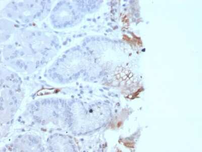 Immunohistochemistry-Paraffin: Von Willebrand Factor Antibody (rVWF/2480) - Azide and BSA Free [NBP3-08944]