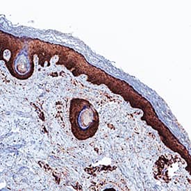 Mouse VisUCyte HRP Polymer-DAB Cell & Tissue Staining Kit (VCTS001B) by ...