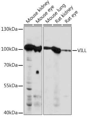 Western Blot: villin-like AntibodyAzide and BSA Free [NBP2-93027]