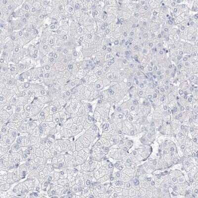 Immunohistochemistry-Paraffin: villin-like Antibody [NBP1-87514]