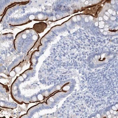 Immunohistochemistry-Paraffin: villin-like Antibody [NBP1-87514]
