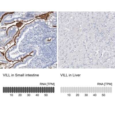 Immunohistochemistry-Paraffin: villin-like Antibody [NBP1-87514]