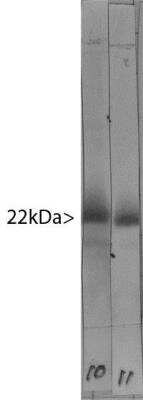Western Blot: visinin-like 1 Antibody (3A9) [NBP2-25167]